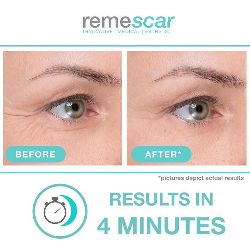 remescar Remescar Eye Cream 8ml / remescar 레메스카 아이크림 8ml