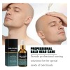 Crema Hidratante Hialurónica Para Cuero Cabelludo Bald Care