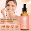 Retinol Serum for Face 2.5%, B5 Resurfacing Retinol Serum with