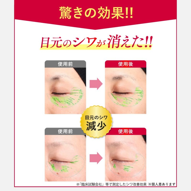 【やずや公式】EFUL リンクルケアクリーム 20g