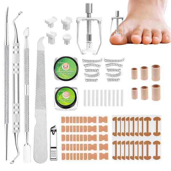 134Pcs Eingewachsene Zehennägel Set Nagelspange Fußnägel Zehennagel Korrektur Zehennagel Eingewachsen