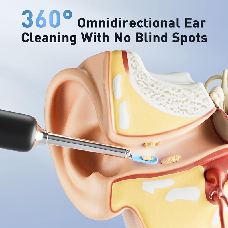 Lebbtl Ear Wax Removal - Electric Ear Irrigation Flushing System,
