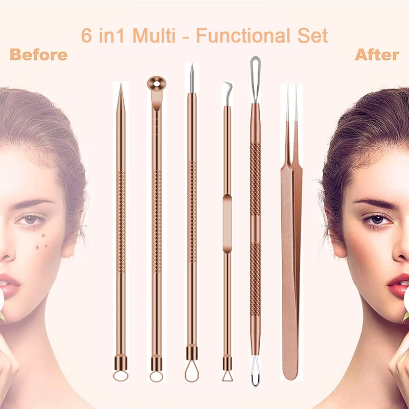 Pimple Popper Tool Kit, 6 Pcs Blackhead Remover Acne Needle
