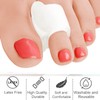 Gel Toe Separators for Women 8 Pieces Toe Spacers for