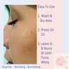 Loma Lux Let's Break Up Hydrocolloid Acne Patches