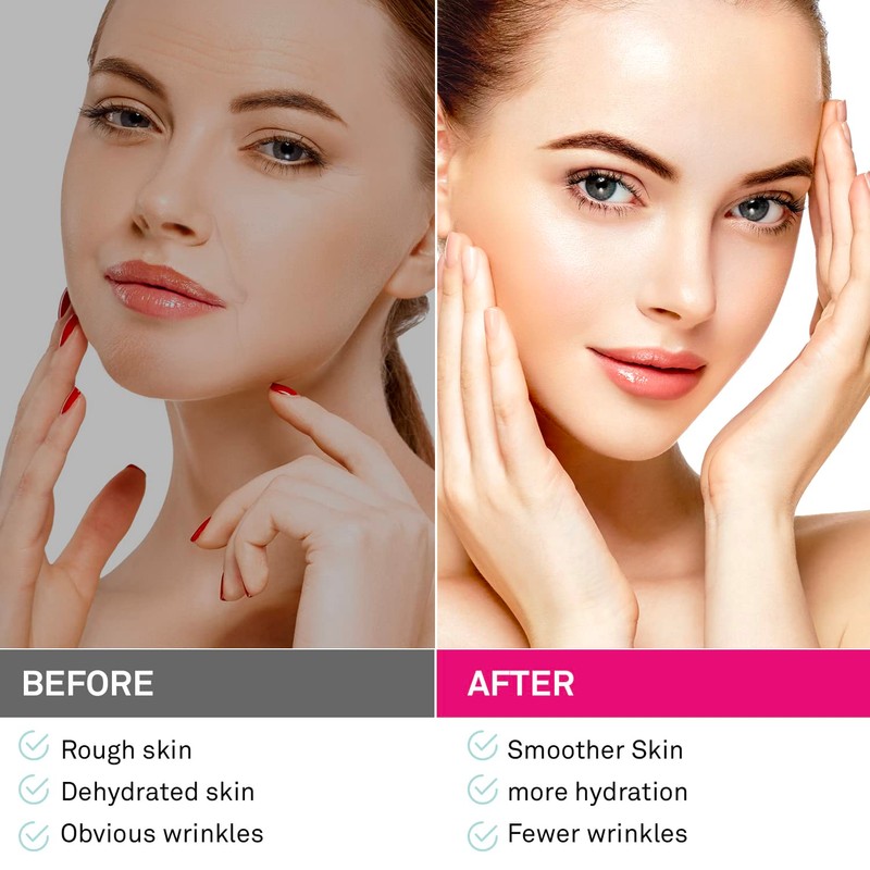 Adellina Facial and Forehead Wrinkle Patches: Face Wrinkle Treatment for