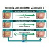 Tt/ Crema Fungicida Para Hongos En Uñas Y Piel De