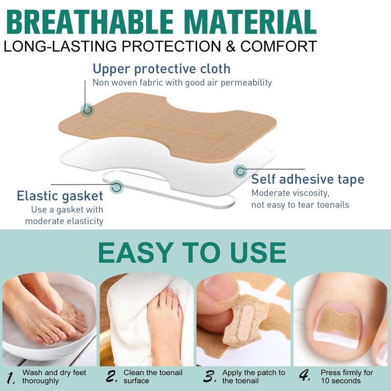 Pack of 50 Toenail Correction Patches for Ingrown Toenails -
