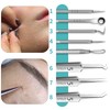Pimple Care Products Sebum Removal Pore Cleansing Acne Management 8-Piece Set Plastic Case