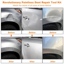 97pcs Dent Puller Kit, Paintless Dent Removal Kit for Dent Removal, Car Dent Puller with Golden Lifter, Bridge Puller, Slide Hammer T-Bar, Dent Remover Tool for Car Refrigerator Door Ding Repair