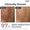 Eucerin Anti-Pigment Day SPF 30 50ml, Day Cream to Reduce