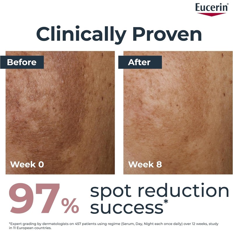 Eucerin Anti-Pigment Day SPF 30 50ml, Day Cream to Reduce