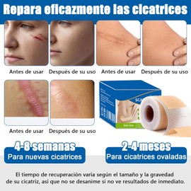 parches de silicona para cicatrices,cinta de silicona para cicatrices, elimina cicatrices nuevas y antiguas, reutilizable,adecuado para todo tipo de cicatrices (300cm)