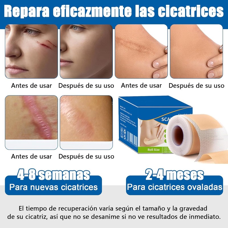 parches de silicona para cicatrices,cinta de silicona para cicatrices, elimina