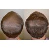 Best Acondicionador de Pérdida de Cabello Terapia de Crecimiento Rápido