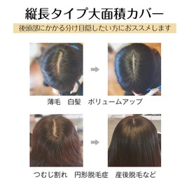 HIYE Partial Wig, Top of the Head, Women's, Fully Hand Planted, 100% Human Hair, Remy Hair, Artificial Skin, Parts, Large Area, Partial Wig, Volume, Freely Parted, Whole Cover, Increased Hair, 3.5 x