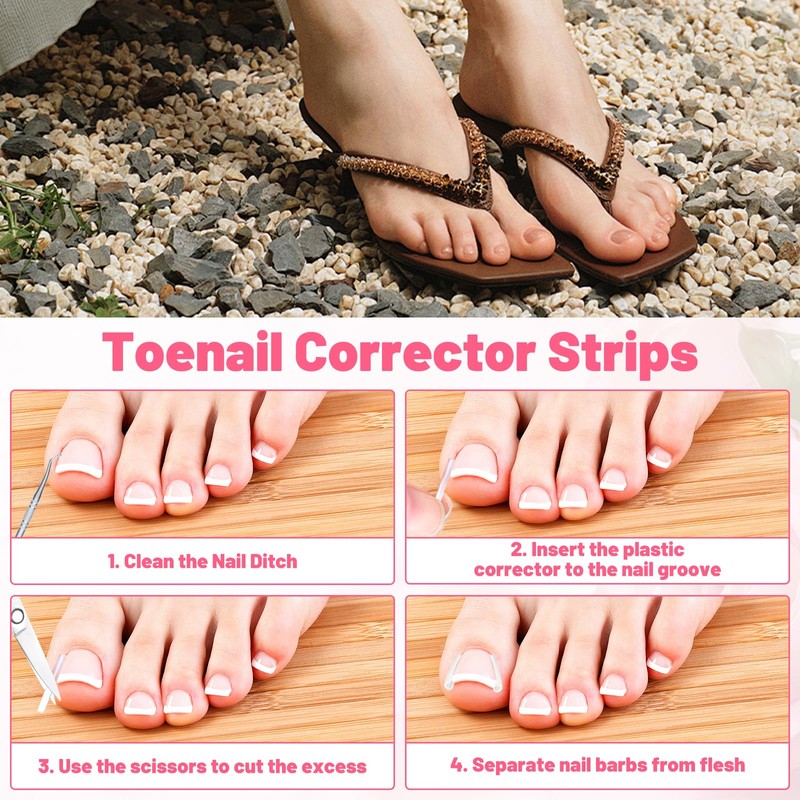 Ingrown Toenail Removal Kit Professional Ingrown Toenail Tool Kit with