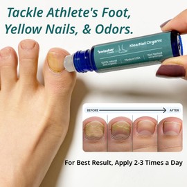 Swissklip KlearNail Toenail Stick | Medi-Care Treatment | Natural Solution for Healthy Nails I Suitable For Foot, Toe, and Fingernail I For Brittle Toenails – 10ml / 0.3 Fl. Oz. Pack 1 - Made in USA