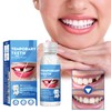 Temporary Tooth Repair Kit, Moldable Filling for Temporary Tooth Repair