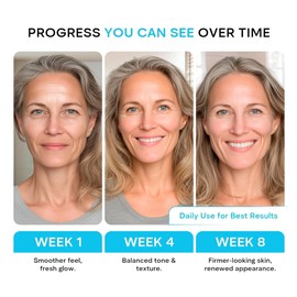 Collagen Retinol Face Moisturizer - Anti Aging Retinol Cream for Skin, Hydrating Moisturizer Face Cream for Wrinkle Reduction & Firmness - Suitable for All Skin Types