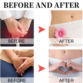 20G Women Private Part Cream,Women's Private Part freshs Cream,Women Privat/e Protection Cre/am,Feminine Crea/m for Priva/te Par/ts,Relieve Itching Priv/ate Cre/am