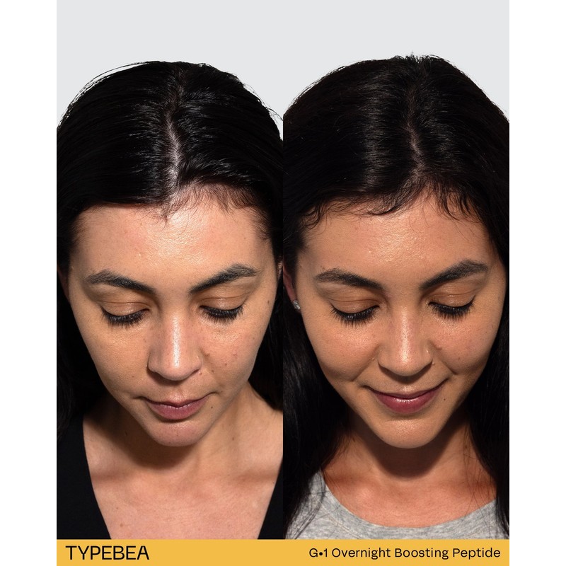 TYPEBEA G1 Overnight Boosting Peptide Serum 10ml
