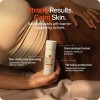 Strawberry® Crema Rejuvenecedora Para Queratosis Pilaris Kp