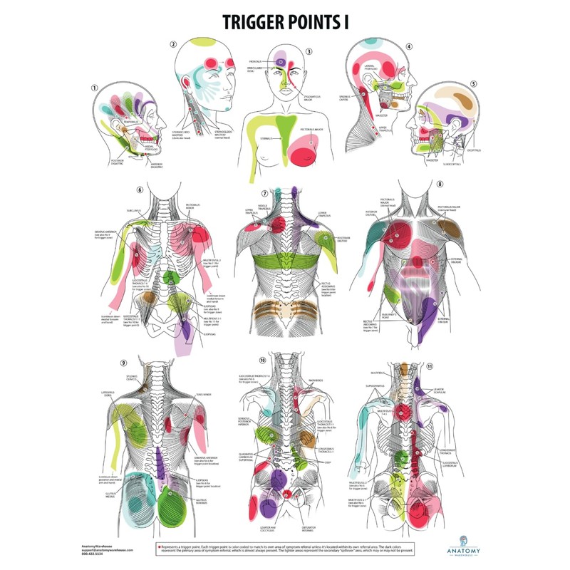 Anatomy Lab Trigger Points I Poster, LAMINATED, Anatomy and Physiology