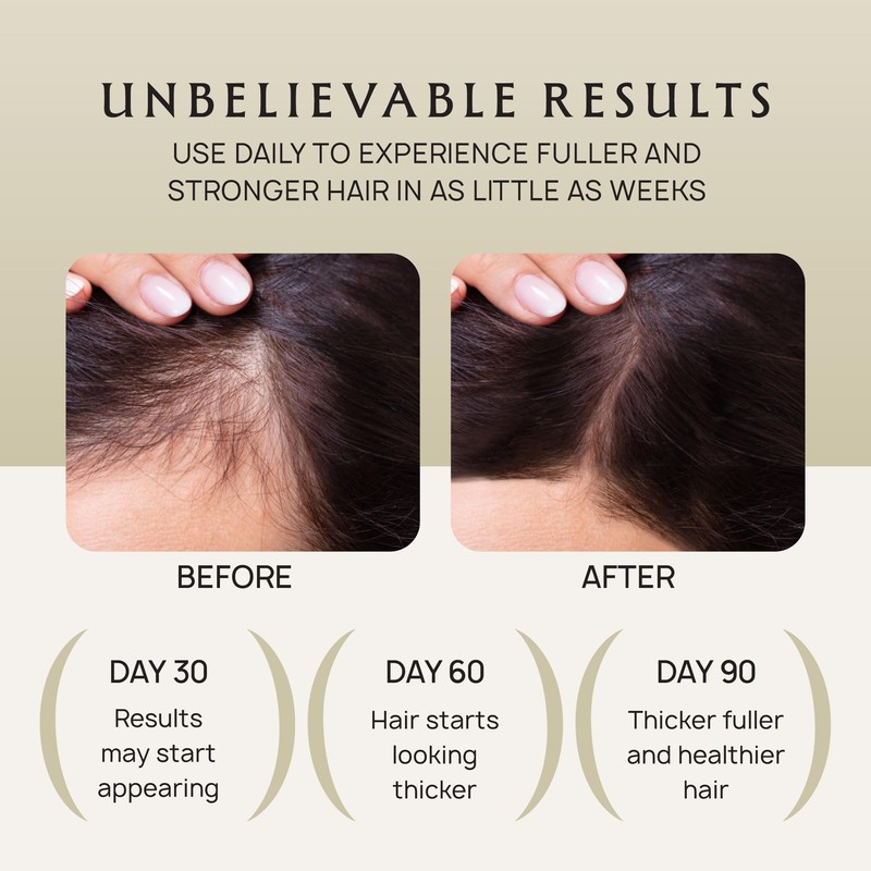 Lebanta Hair Growth Oil Spray - 100% Pure Ingredients For