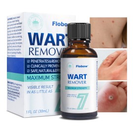 Líquida De Eliminación De Verrugas Y Mezquinos 30ml