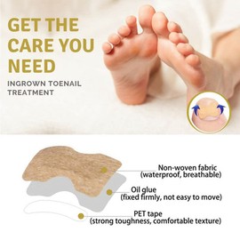 50 Pcs Glue Free Toenail Toe Ingrown Nail Correction Patch Nail Sticker Foot Care, Nail Correction Stickers for Men Women