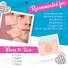 Bye Bye Blemish For Acne Drying Lotion 1 oz (