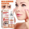 South Moon Eye Area Milia Care Essence One Size / Style 1