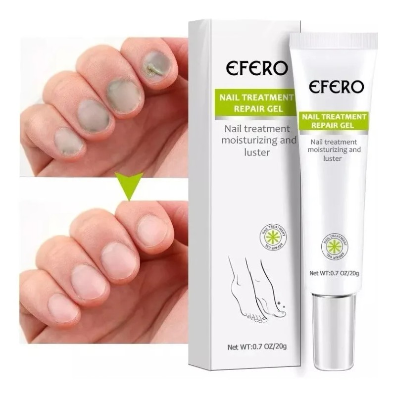 Gel Antihongo Tratamiento Reparador De Uñas Efero 2 Piezas