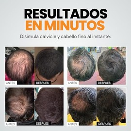 Henrys Fibras Capilares Castaño Oscuro 27.5g, Disimula Calvicie y Caída del Cabello, Aporta Volumen y Densidad al Instante
