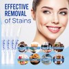 VieBeauti Teeth Whitening Pen (4 Pcs), 40+ Uses, Effective, Painless,