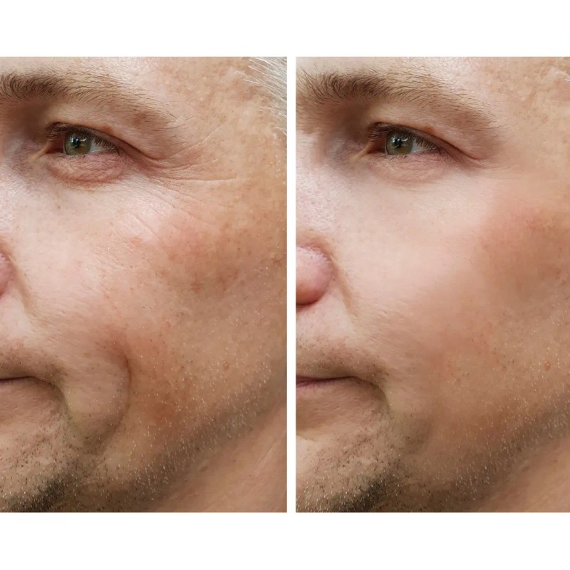 Crema Aclarante Hombre Para Manchas Y Arrugas, Natural