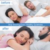 Anti Snoring Chin Strap, Update Snoring Stopper Snoring Solution Professional