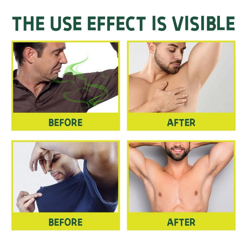 Barra Limpiadora Acidificada X Soap