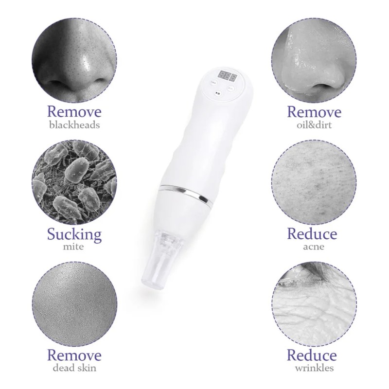 Microdermoabrasion Peeling 3 Puntas Diamante C/caja