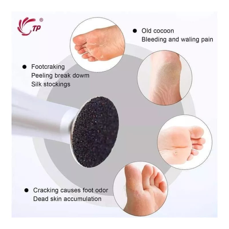 Kalanzi Repuesto Para Removedora De Callos, Devastadora De Uñas