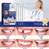30ML Temporary Tooth Filling,Moldable False Teeth for Fixing,Temporary Tooth Repair
