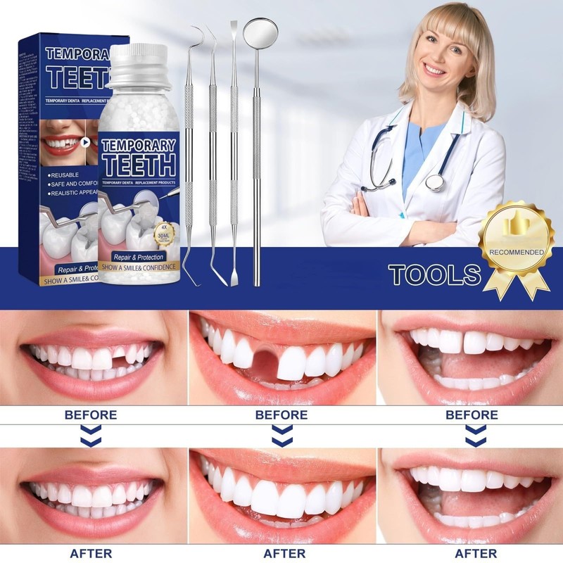 30ML Temporary Tooth Filling,Moldable False Teeth for Fixing,Temporary Tooth Repair