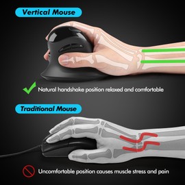 MicroPack mouse ergonómico, mouse inalámbrico vertical con receptor USB A y tipo C, diseño Ergo reduce la tensión muscular, 6 botones 800/1200/1600 DPI para Windows, Mac, PC, portátil, negro