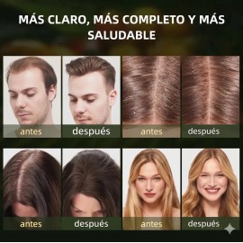 Shampoo Batana Oil 420ml Tratamiento Capilar Anticaida. Shampoo Para El Crecimiento Del Cabello Control De Caspa Hidratacion Profunda Brillo Y Fuerza 