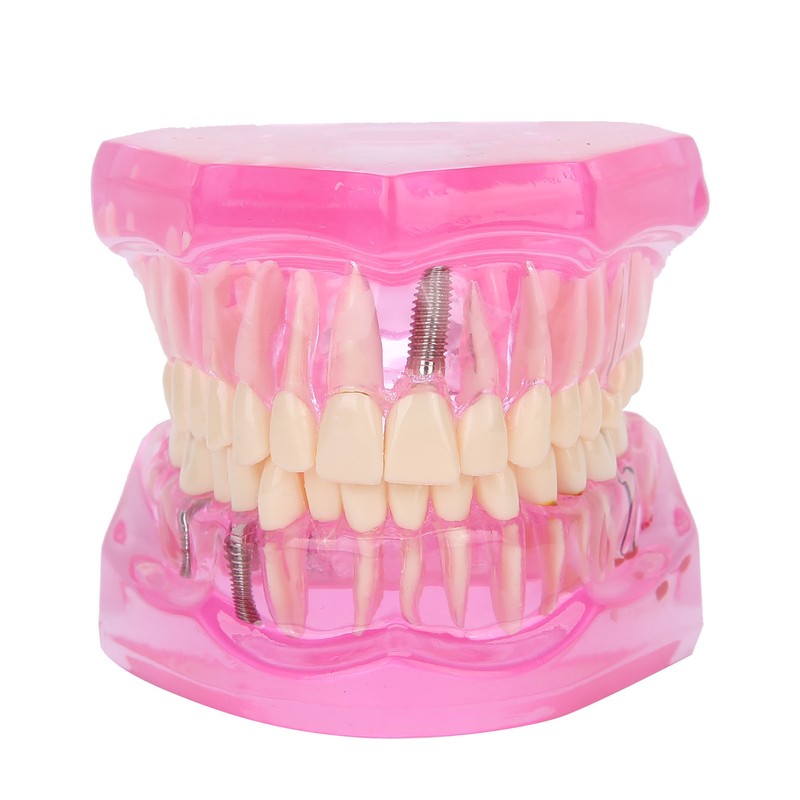 Transparent Adult Teeth Model Pathological Repair Studying Dental Teaching Tools