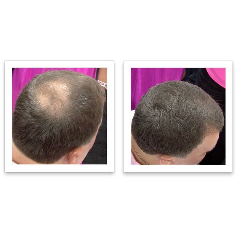 Caboki Hair Loss Concealer Trial Pack (Dark Brown)