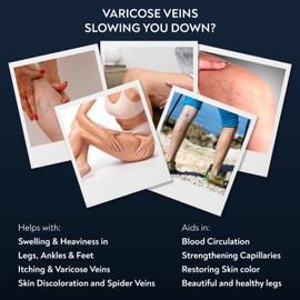PENIKOSETE Penikosete Varicose Veins Care | Natural Ayurvedic Cream for Legs with Ashwagandha | Spider Vein Removal Cream for Improved Circulation & Relief from Heavy Fatigued Legs | Non-Sticky