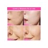 2pz Arbutin 7.0+txa 4.0.cream,cremas De Manchas Faciales