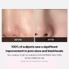 Cojín Tónico Facial Medicube Zero Pore Pads 2.0 Para T